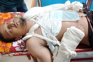 মারধরের পর পাঁচতলা থেকে ফেলে দেওয়ার অভিযোগ, জাবি কর্মচারীর হাত-পা, বুক ও কোমরের হাড় ভাঙা