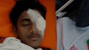 হবিগঞ্জে হামলায় গুরুতর আহত ছাত্রশক্তি নেতা আলিফ চৌধুরীর বাঁ চোখে অস্ত্রোপচার, দৃষ্টি হারানোর শঙ্কা