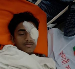হবিগঞ্জে হামলায় গুরুতর আহত ছাত্রশক্তি নেতা আলিফ চৌধুরীর বাঁ চোখে অস্ত্রোপচার, দৃষ্টি হারানোর শঙ্কা
