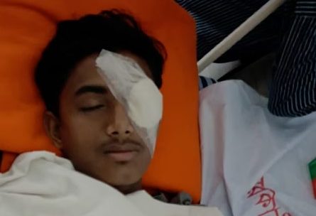 হবিগঞ্জে হামলায় গুরুতর আহত ছাত্রশক্তি নেতা আলিফ চৌধুরীর বাঁ চোখে অস্ত্রোপচার, দৃষ্টি হারানোর শঙ্কা